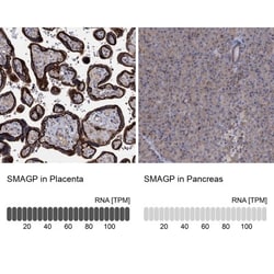 SMAGP Antibody, Novus Biologicals:Antibodies:Primary Antibodies